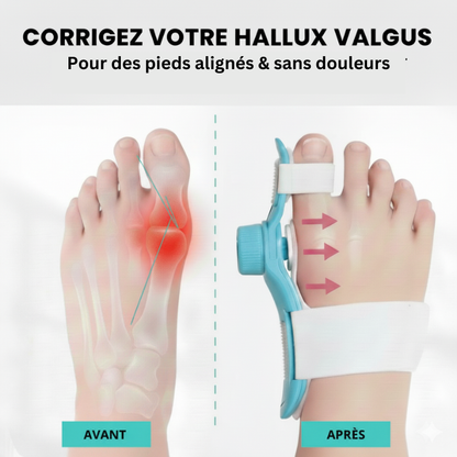 Correcteur Hallux Valgus Pro